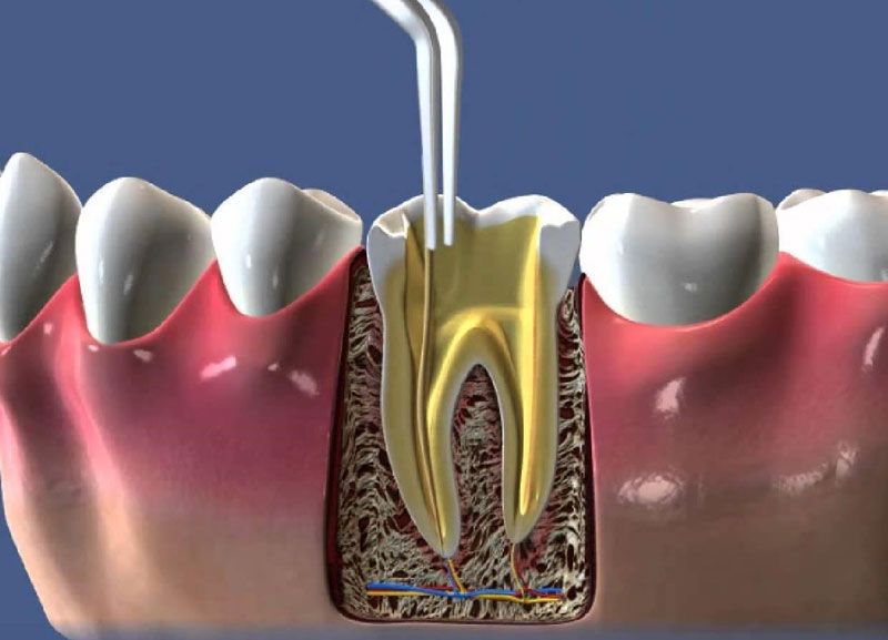 имплантация зубов в рязани