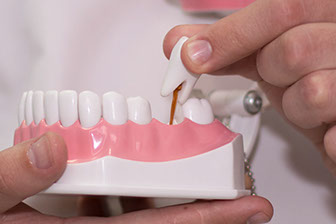 протезирование зубов рязань