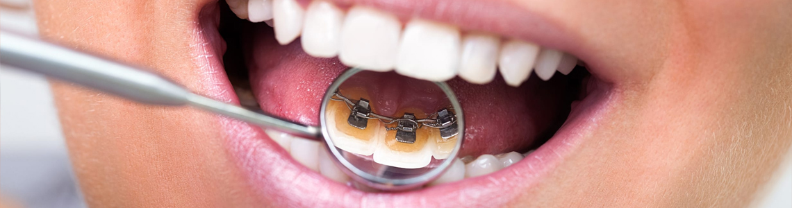 детская стоматология ортодонт