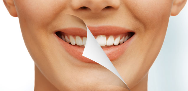 стоматология Рязань, отбеливание зубов Рязань