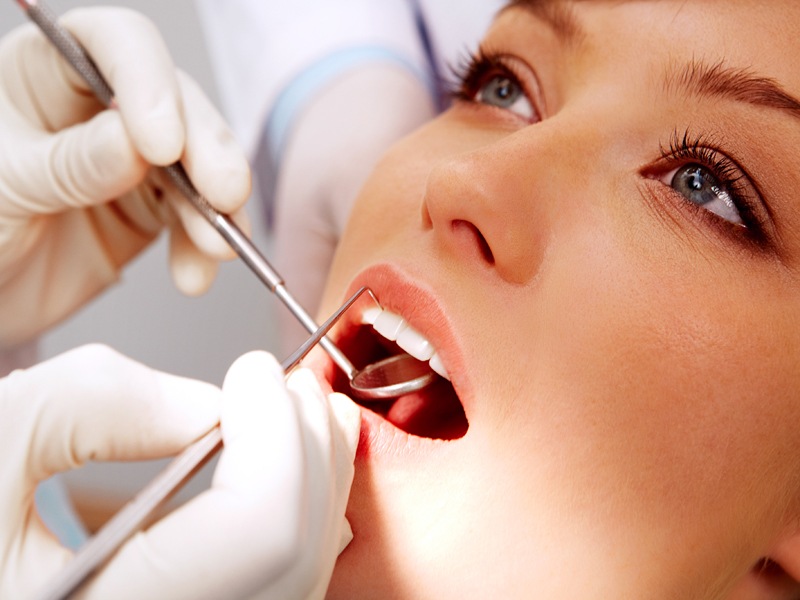 стоматология рязань, изнашивание пломб